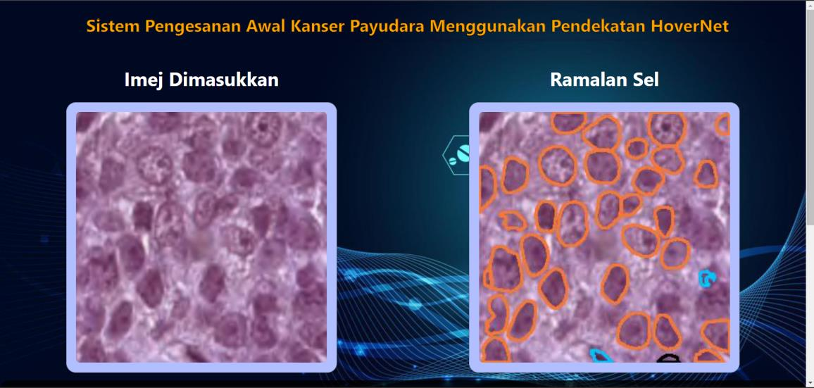 Breast cancer prediction system — interface