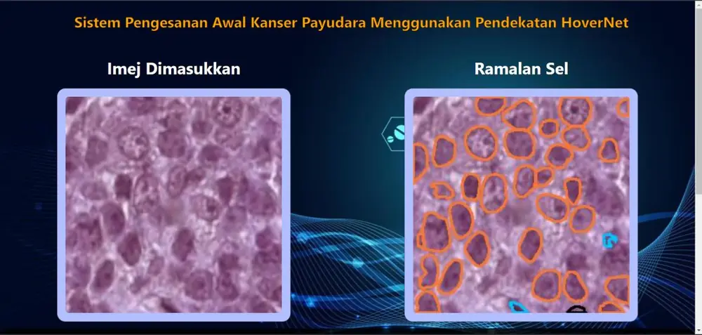 Breast cancer prediction interface